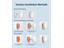 SONOFF SNZB-01P Is A Compact ZIGBEE Wireless Smart Switch That Can Even Fit In Your Pocket, Offering Preset Actions For Single Press, Double Press, And Long Press To Control Multiple Devices. Battery Included. Please Note: This Requires A ZIGBEE Bridge [SONOFF SNZB-01P W/LESS SWITCH]